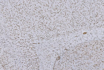 Anti-HP1 alpha/CBX5 Antibody (monoclonal, 8G6)