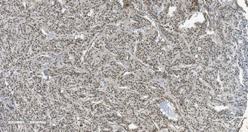 Anti-HP1 alpha/CBX5 Antibody (monoclonal, 8G6)