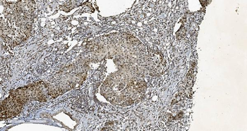 Anti-HP1 alpha/CBX5 Antibody (monoclonal, 8G6)