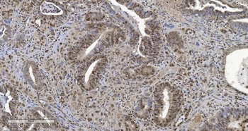 Anti-HP1 alpha/CBX5 Antibody (monoclonal, 8G6)