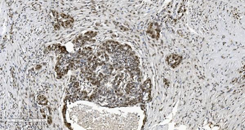 Anti-HP1 alpha/CBX5 Antibody (monoclonal, 8G6)