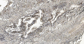 Anti-HP1 alpha/CBX5 Antibody (monoclonal, 8G6)