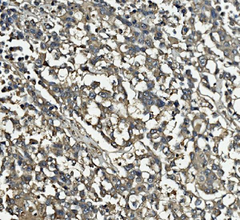 Anti-Clathrin heavy chain/CLTC Antibody (monoclonal, 6D3)