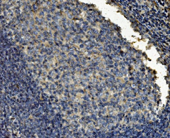 Anti-Clathrin heavy chain/CLTC Antibody (monoclonal, 6D3)