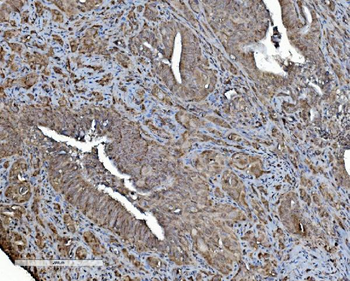 Anti-REA/PHB2 Antibody (monoclonal, 2B5)