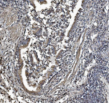 Anti-REA/PHB2 Antibody (monoclonal, 2B5)