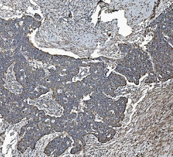 Anti-REA/PHB2 Antibody (monoclonal, 2B5)