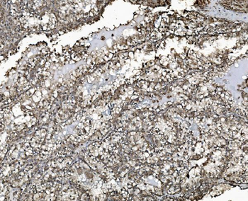 Anti-REA/PHB2 Antibody (monoclonal, 2B5)