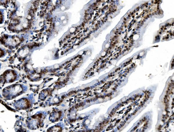 Anti-REA/PHB2 Antibody (monoclonal, 2B5)