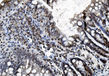 Anti-REA/PHB2 Antibody (monoclonal, 2B5)