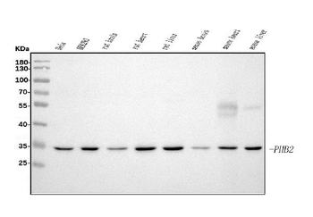 Anti-REA/PHB2 Antibody (monoclonal, 2B5)