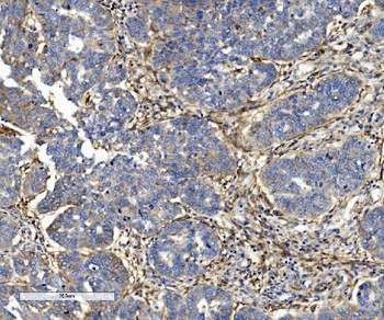 Anti-Integrin beta 5/ITGB5 Antibody (monoclonal, 9E2)