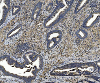 Anti-Integrin beta 5/ITGB5 Antibody (monoclonal, 9E2)