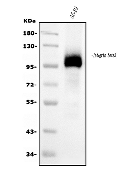 Anti-Integrin beta 5/ITGB5 Antibody (monoclonal, 9E2)