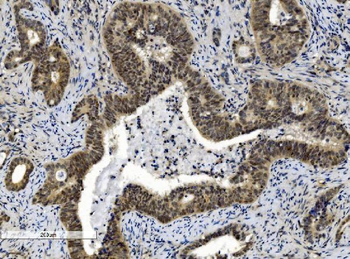 Anti-Cbx8 Antibody (monoclonal, 8G7)