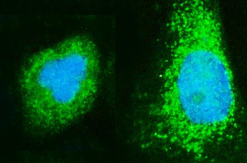 Anti-ARF6 Antibody