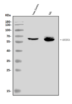 ARID5A Antibody