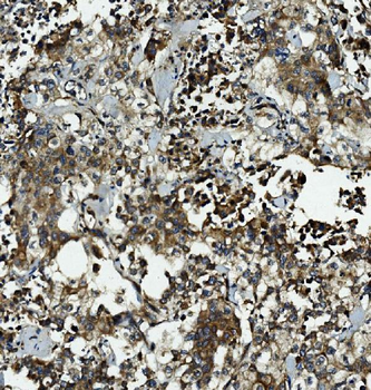 Anti-Caspase-5/CASP5 Antibody