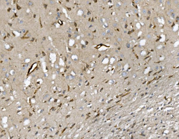 CD34 Rabbit Polyclonal Antibody