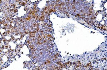 Anti-CD226 Antibody