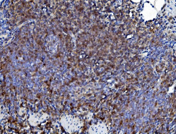 Anti-CD226 Antibody
