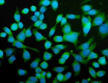 Anti-CPN1 Antibody