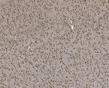 Anti-EPRS1/PARS Antibody