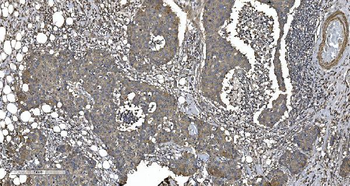 Anti-EPRS1/PARS Antibody