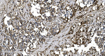 Anti-EPRS1/PARS Antibody