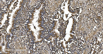 Anti-EPRS1/PARS Antibody