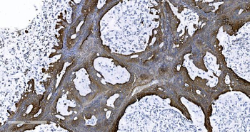Anti-EPRS1/PARS Antibody
