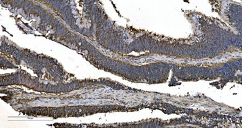 Anti-EPRS1/PARS Antibody