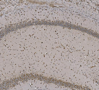 Anti-EPRS1/PARS Antibody