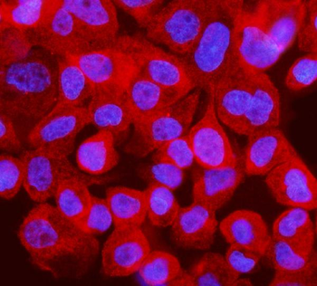 Anti-IRF3 Antibody