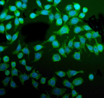 Anti-PDIA5 Antibody