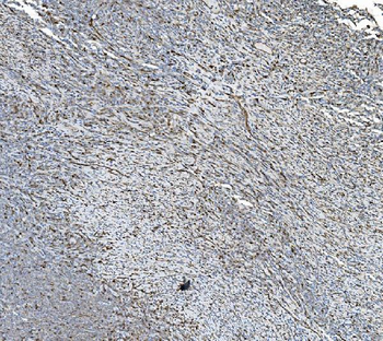 Anti-PDIA5 Antibody