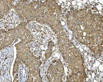 Anti-PDIA5 Antibody