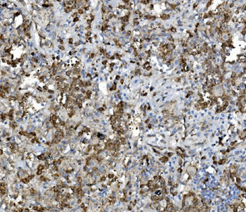 Anti-PDIA5 Antibody