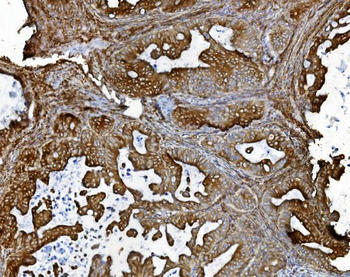 Anti-PDIA5 Antibody