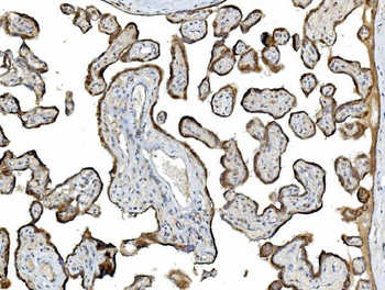 Anti-PDIA5 Antibody