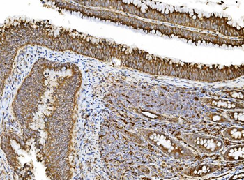 Anti-PDIA5 Antibody