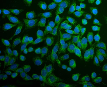 Anti-PDIA6 Antibody