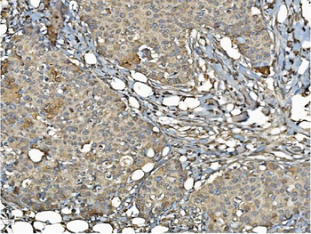 Anti-PDIA6 Antibody