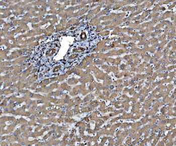 Anti-PDIA6 Antibody