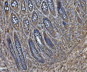 Anti-PDIA6 Antibody