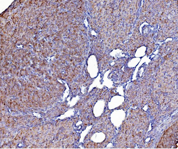 Anti-PDIA6 Antibody