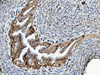 Anti-PDIA6 Antibody