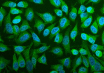 Anti-PFAS Antibody