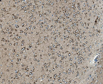 Anti-Prohibitin/PHB Antibody