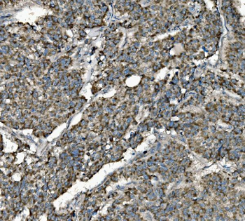 Anti-Prohibitin/PHB Antibody